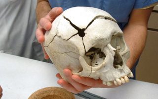 Forensic anthropology and the ‘Stories in the Bones’
