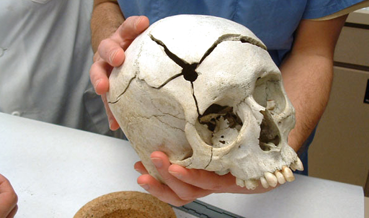 Forensic anthropology and the ‘Stories in the Bones’